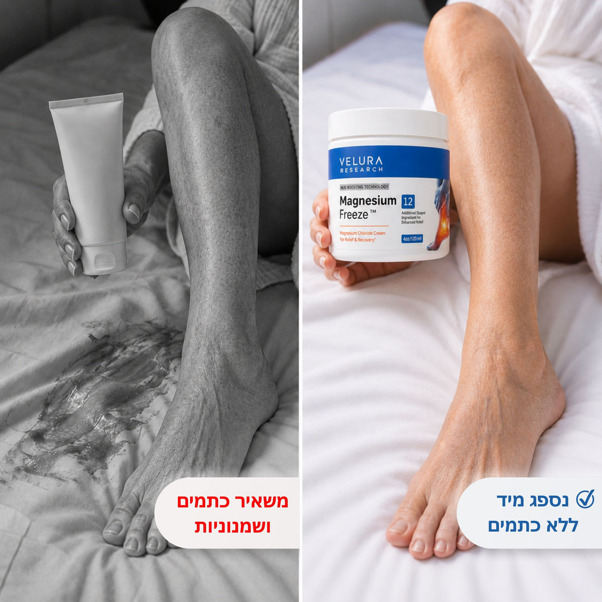 Magnesium Freeze קרם מגנזיום כלורידי להקלה מהירה